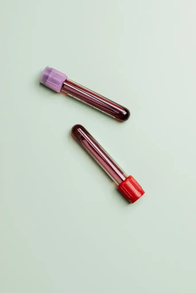 How Long Do Drugs Stay In Your System? Two blood samples.