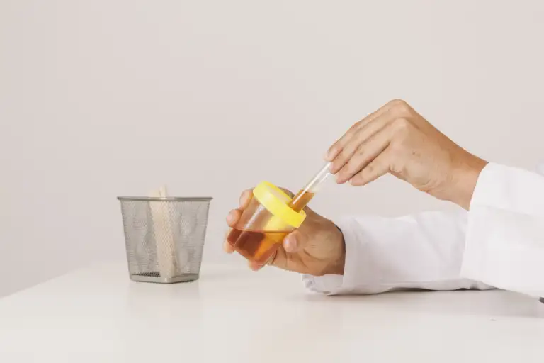 How Far Back Does a Lab Urine Test Go?