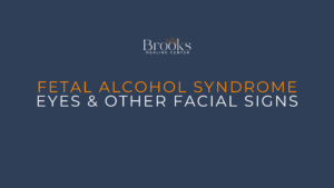 Fetal Alcohol Syndrome Eyes & Face Blog